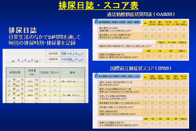 おしっこの話