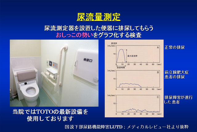 おしっこの話